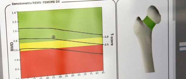 Dispositivo mobile REMS (particolare)