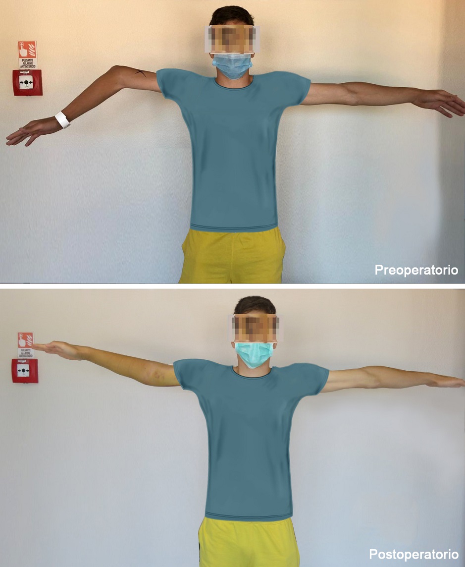 The patient before and after the intervention