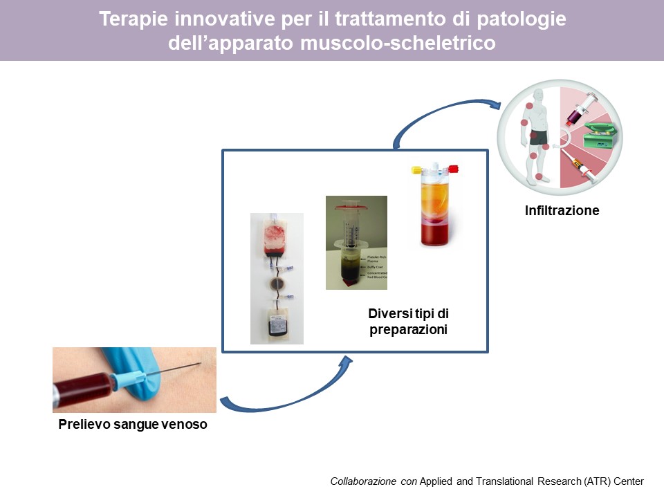 Figure 2: Characterization of biological compounds (PRP, PRF, APS) and their activity on cell cultures (chondrocytes, synoviocytes, mesenchymal cells)