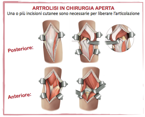 Fig. 14