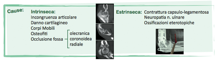 Fig. 8 - Classificazione delle cause della rigidità del gomito