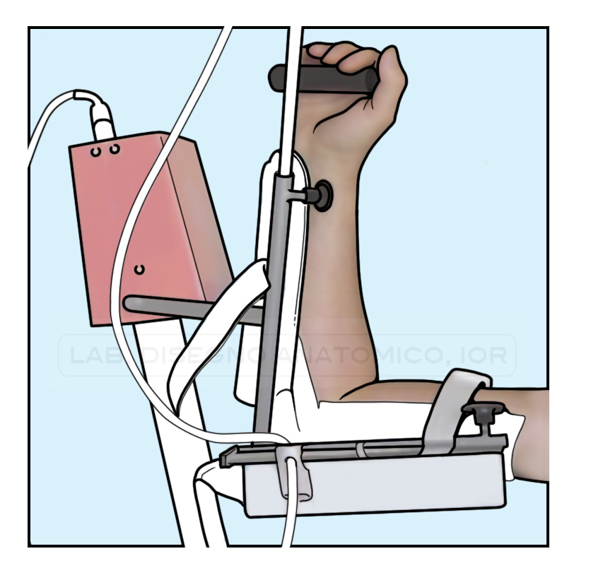 Fig. 10 - Mobilizzatore meccanico articolare